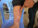 Nhóm côn đồ lao vào nhà dân chém tán loạn rồi ném bom xăng