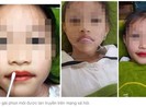 Cha phun xăm môi cho con gái 5 tuổi có phạm luật?