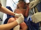 Cô giáo dùng cồn để dạy PCCC, 3 trẻ bị bỏng nặng