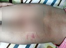 Bé ba tuổi bị đánh vì đi vệ sinh nhiều lần
