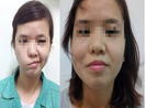 Cô gái 20 năm mới dám cười