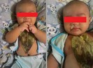 Gây hại con trẻ vì tin vào bài thuốc dân gian