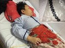 Làm rõ vụ bé trai nuốt 9 viên bi vào bụng