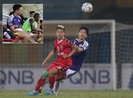 Thầy Park bị gãy hàng thủ