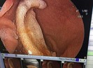 Công an vào cuộc vụ cắn đứt tai bạn rồi nuốt vào bụng