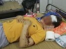Người phụ nữ ghen ngược, tạt acid vào vợ nhân tình