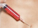 Sẽ áp giải nữ giám đốc thuê người truyền HIV đến tòa