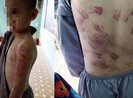 Sự thật bé trai mồ côi bị sư cô đánh tím khắp người
