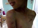 Sư chùa dùng đòn roi đánh bé trai bầm tím cơ thể