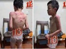 'Bé trai bị bố dượng đánh': Công an 36 xã thị trấn xác minh