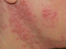 Nắng nóng 'hành hạ' làn da người dân Bình Thuận