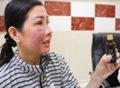 Mặt nham nhở do bôi mỹ phẩm 'trời ơi đất hỡi'