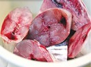 Cô gái tổn thương phổi nặng, suýt chết sau khi ăn cá ngừ