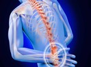 Coi chừng tàn phế vì coi thường đau lưng