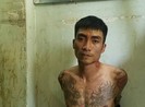 Nữ hộ sinh bị đánh vỡ hốc mắt, xương mũi trong thang máy