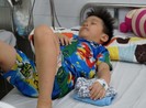 Thủng dạ dày và ruột vì 3 viên bi nam châm hít chặt nhau