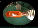 Bé gái 10 tháng tuổi đột nhiên ói liên tục vì lý do này