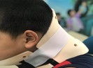 Học nhào lộn trên TikTok, bé trai chấn thương cột sống cổ