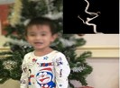 Bé trai 3 tuổi đột quỵ vì nguyên nhân không ngờ