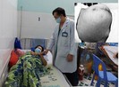 Ung thư giai đoạn muộn do bụng căng lên mà không đi khám