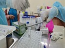 Hơn 1.000 người ở BV Mắt TP.HCM xét nghiệm khẩn COVID-19