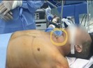 Cứu người đàn ông tự dùng kéo đâm vào cổ