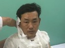Thanh niên cướp ngân hàng ở Bình Tân gây án như thế nào