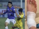 Khi Thiên Trường không phải là thiên đường