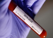 Người nghi ngờ nhiễm virus Corona, nên khám ở đâu?