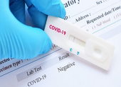 Bộ Y tế ban hành thông tư hướng dẫn giá xét nghiệm SARS-CoV-2