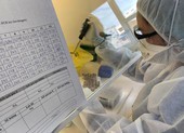 CDC TPHCM không mua kit test của công ty Việt Á vì giá quá đắt