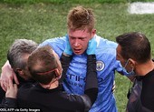 HLV tuyển Bỉ nói về khả năng tham dự Euro 2020 của De Bruyne