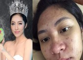 Hoa hậu Đại dương Đặng Thu Thảo kể về khoảng thời gian bị trầm cảm sau sinh