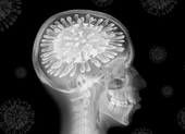 Chứng sương mù não: Virus SARS-CoV-2 đã làm gì với não bộ bệnh nhân COVID-19?