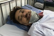 1 người dân tố bị 911 Đà Nẵng đánh vỡ xương mũi