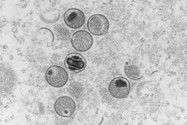 Hình chụp kính hiển vi điện tử cho thấy mặt cắt siêu mỏng của virus đậu mùa khỉ.