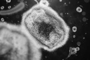Hình chụp virus đậu mùa khỉ từ kính hiển vi điện tử. 