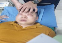 Nam thanh niên sốc phản vệ nặng sau khi thái một củ hành