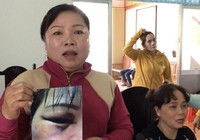 Tòa hoãn xử do thẩm phán bận công tác đột xuất
