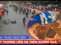 Đời cua rơ té đau, đứng dậy và vết thương chưa liền da...