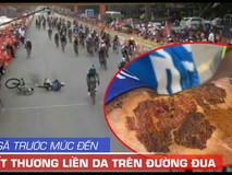 Đời cua rơ té đau, đứng dậy và vết thương chưa liền...