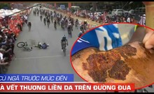 Đời cua rơ té đau, đứng dậy và vết thương chưa liền da...