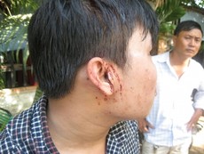 Clip công an dựng lại hiện trường vụ hai phóng viên bị hành hung