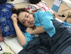 Điều tra vụ 1 phụ nữ bị đánh bầm mắt ở quán bánh xèo