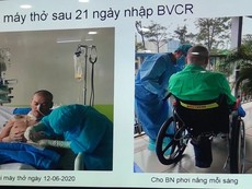 100 ngày hồi sinh kỳ diệu của nam phi công người Anh