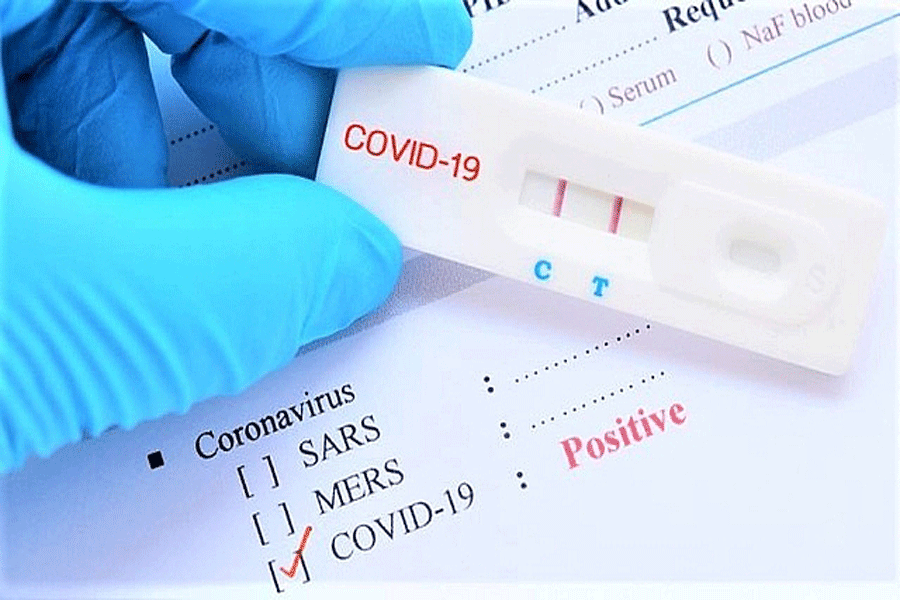 Sở Y tế Tiền Giang nói về thông tin 'mua test nhanh COVID giá cao' - ảnh 1