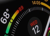 Apple Watch sẽ đo được huyết áp và chỉ số đường huyết?