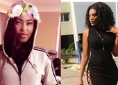 Nữ hoàng sắc đẹp Nigeria chết vì phẫu thuật mông