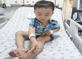 Cậu bé 4 tuổi bị rắn cắn khi đang thả diều