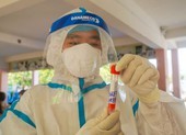 Đà Nẵng: 1 công an mắc COVID-19 sau 2 lần xét nghiệm âm tính